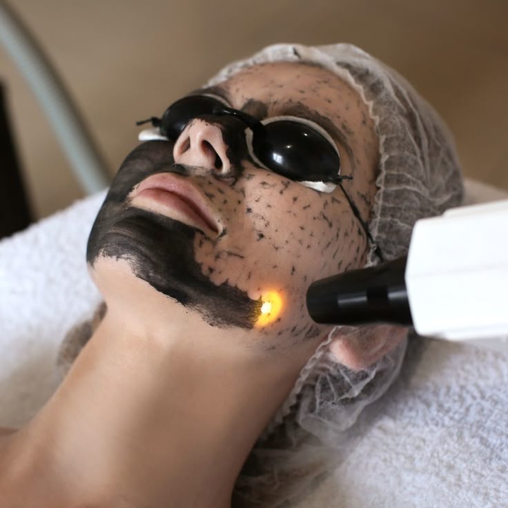 Carbon facial